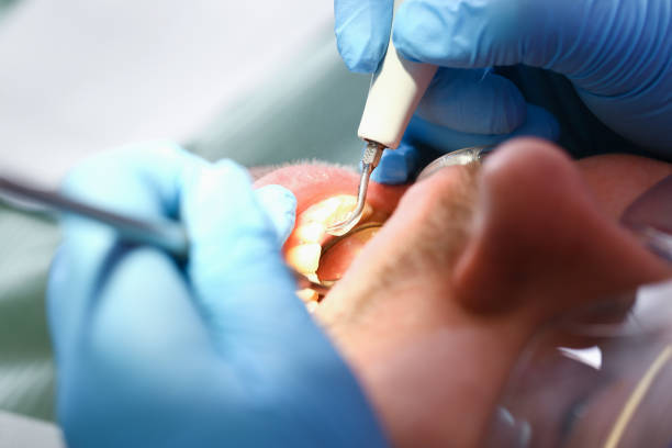 Best Walk-In Emergency Dentist in Williamson, AZ